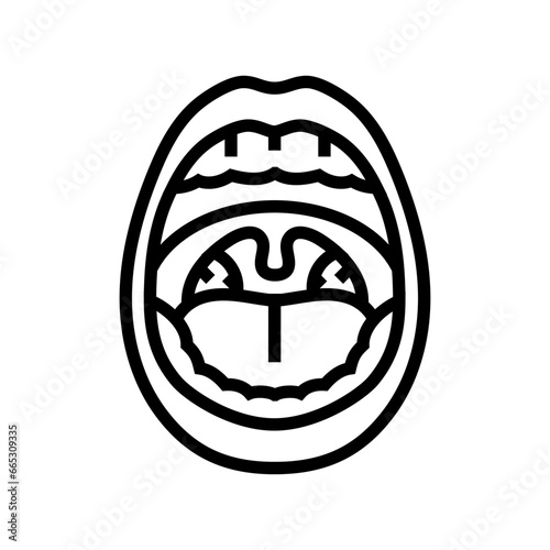 swollen tonsils disease symptom line icon vector. swollen tonsils disease symptom sign. isolated contour symbol black illustration