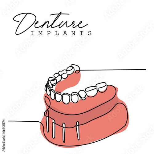 line art of Orthodontic treatment. Dentists day and respect for their services to humanity. Dental procedures vector art concept. Isolated vector of teeth and jaws. Retainers braces denture