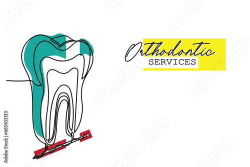  line art of Orthodontic treatment. Dentists day and respect for their services to humanity. Dental procedures vector art concept. Isolated vector of teeth and jaws. Retainers braces denture