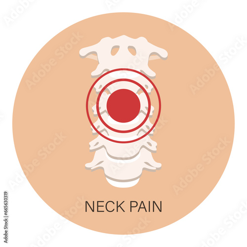 Pain in the cervical vertebrae, osteoarthritis, rheumatoid arthritis. Anatomy of human bones. Illustration, vector