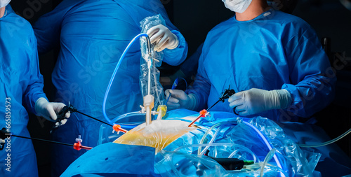 A team of surgeons in a dark operating room under the light of surgical lamps performs an operation to remove a cancerous tumor in a patient's intestine. Minimally invasive laparoscopic surgery. photo