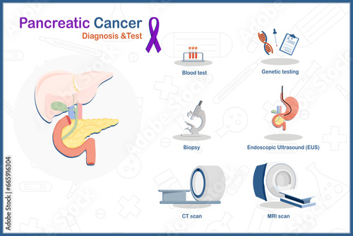 health care concept In flat medical vector illustration. Prostate cancer diagnosis and test,blood test,mri scan,ct scan,biopsy,genetic testing and endoscopic ultrasound.isolated on white background.