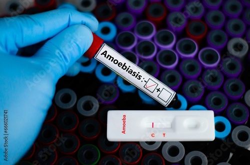 The patient negative for amoebiasis by rapid diagnostic test. photo