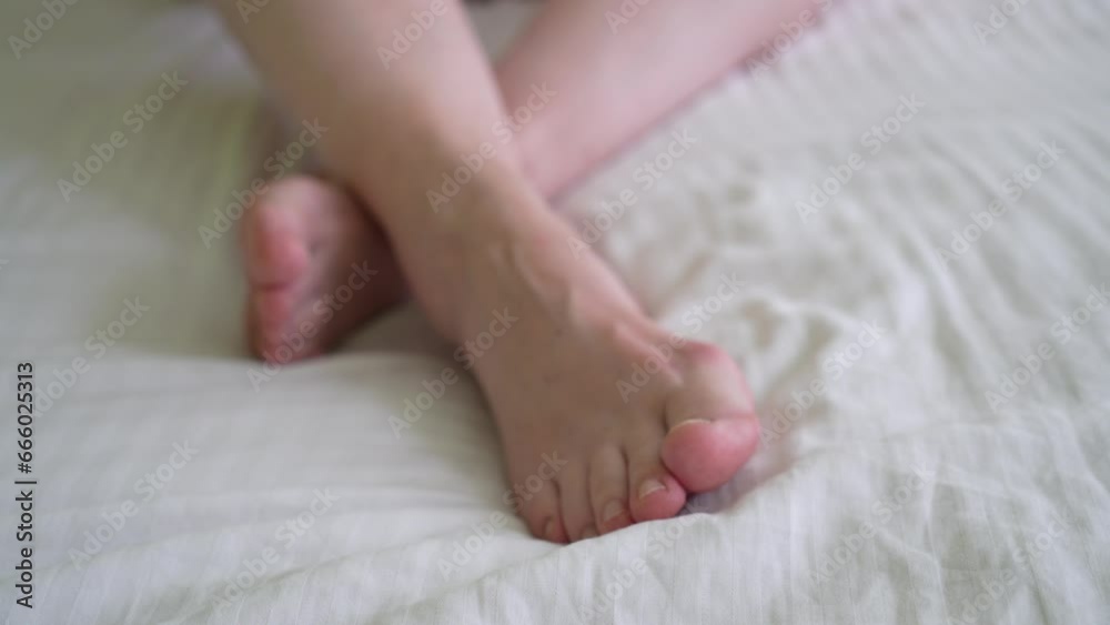 female legs with problem with women's feet, bunion toes in bare feet. Hallus valgus, female legs with problem with women's feet, bunion toes in bare feet. Hallus valgus,
