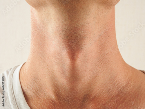 Adam's apple in a man, close-up structure of cervical cartilage organs