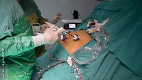 Obesity surgery. Weight loss surgery is performed with laparoscopic surgery. Operating room doctor and team performing surgery