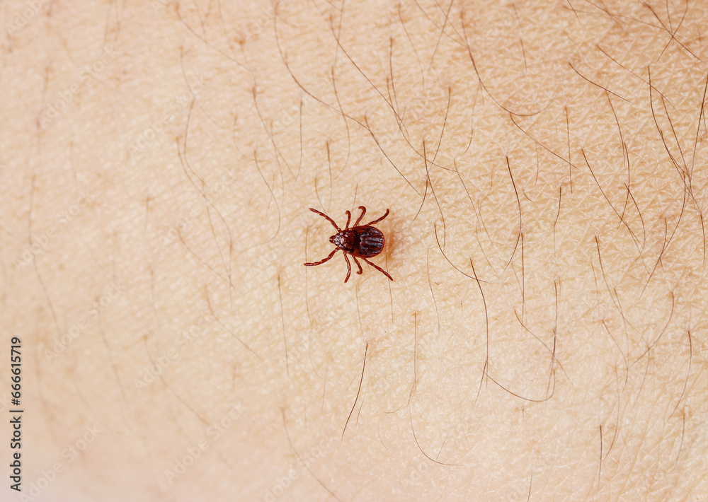 Tick crawling on human skin