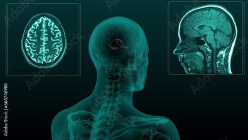 Magnetic Resonance Imaging, 3d render, brain, fornix cerebri, Brain stem, MRI, animation, hologram, render, dark, roentgen, cranium, physical, neurosurgery, 3d, radiological, blue, spinal, man, diagno photo