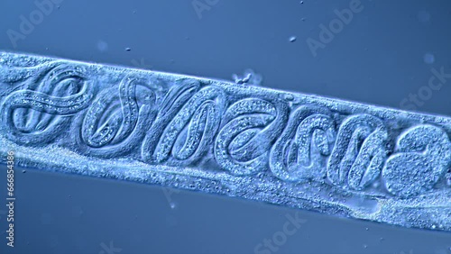 Close up of Vinegar eel nematode mother worm revealing different developmental stages of worm embryos  photo