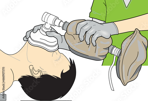 vector illustration of artificial ventilation bag and masks ambu