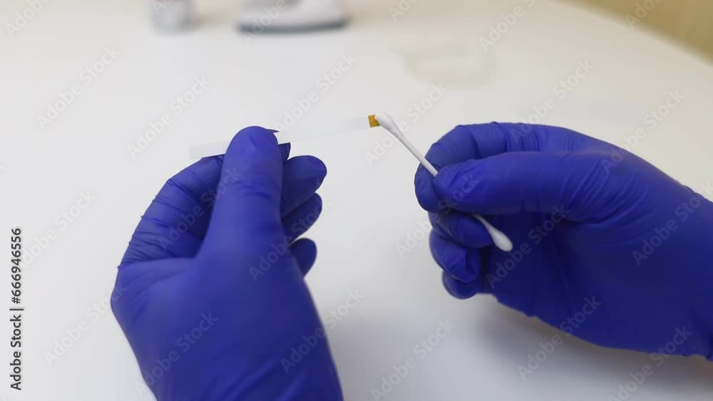 Bacterial Vaginosis. Vaginal pH. Diagnostic. Scale by which you can