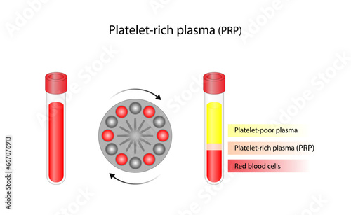 Platelet-rich plasma (prp). Autologous conditioned plasma, is a concentrate of platelet-rich plasma extracted from whole blood. After centrifugation, Extract PRP and Inject. Vector Illustration