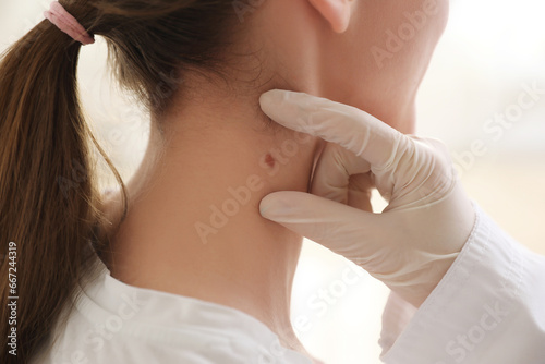 Fotografie Dermatologist examining mole on young woman's neck in clinic, closeup