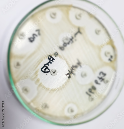 Antimicrobial susceptibility testing in culture plate. Drug sensitivity test, disk drug, antibiotic sensitivity, Co-trimoxazole sensitive. photo