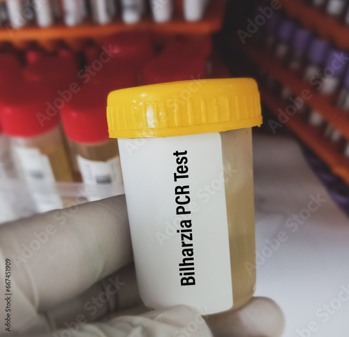 Urine sample for Real time PCR Bilharzia test to diagnosis of schistosomiasis. photo