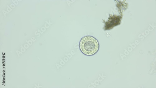 Larva sea urchin Strongylocentrotus pallidus under microscope, phylum Echinodermata. Blastula stage. White sea photo