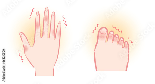 しもやけ・凍瘡で痒そうな手と足の指のイラストセット