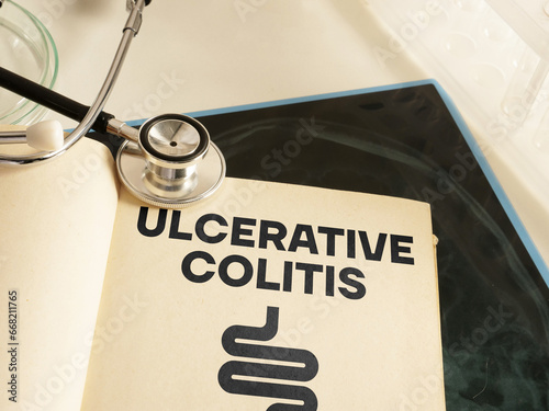 Ulcerative colitis is shown using the text and picture of intestine in the book photo