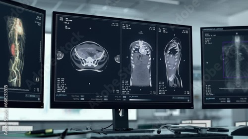 Medical research scanner examining the patients body at the hospital. Medical research scanner studying the chest organs. Medical research scanner imaging the human chest cavity. Healthcare.