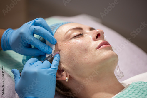 Injection facial rejuvenation. Biorevitalization and mesotherapy. A cosmetologist injects cosmetic preparations into the facial skin to moisturize, firm and rejuvenate the skin.
