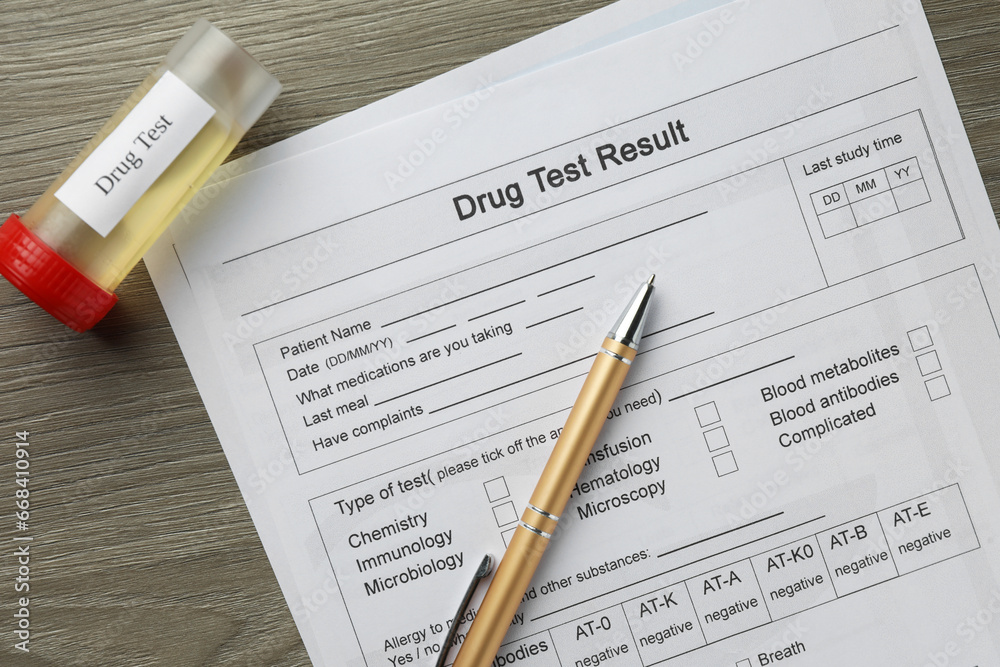 Drug test result form, container with urine sample and pen on wooden table, flat lay Drug test result form, container with urine sample and pen on wooden table, flat lay