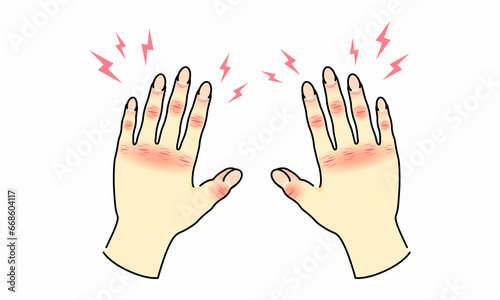 Wallpaper Mural 手荒れ 両手 Torontodigital.ca