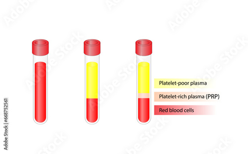 Platelet-rich plasma (prp). Autologous conditioned plasma, is a concentrate of PRP extracted from whole blood. After centrifugation, extract PRP and inject hair, skin or knee. Vector Illustration