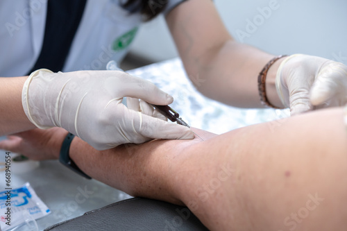 Close up hand of nurse  taking blood sample from a patient in the hospital. 