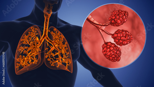 Fotografía Alveoli and the bronchial tree in the human respiratory system