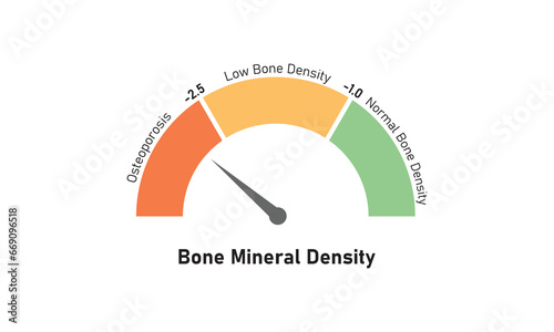 Bone Mineral Density Level Concept Design. Vector Illustration.	