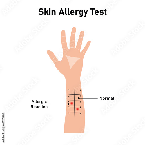 Skin Allergy Test Scientific Design. Vector Illustration.