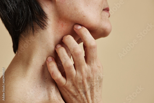 Closeup of adult woman with short hair scratching neck suffering from anxiety or skin condition, copy space photo