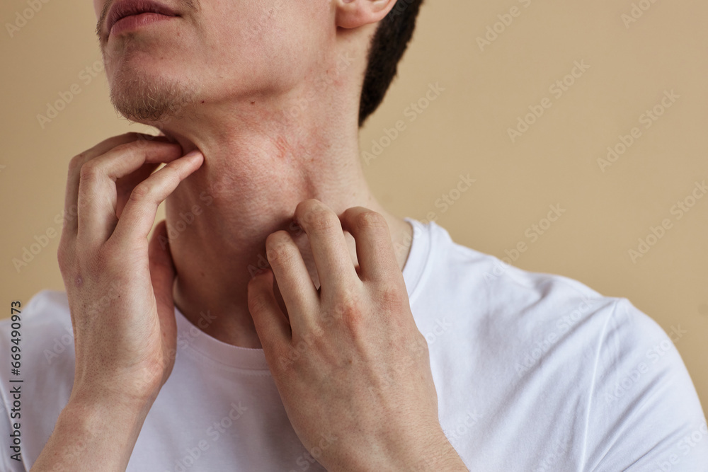 Close up of young man scratching neck suffering from itch and allergies, copy space Close up of young man scratching neck suffering from itch and allergies, copy space