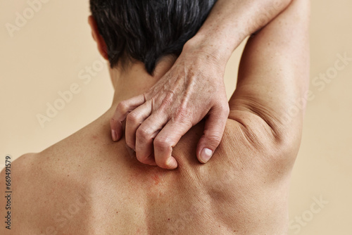 Rear view closeup of mature woman scratching bare back against beige background, copy space
