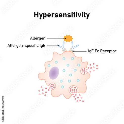 Hypersensitivity Reaction Scientific Design. Vector Illustration.