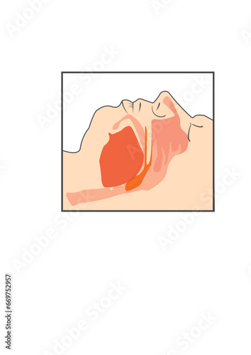 Anatomy of Airway illustration