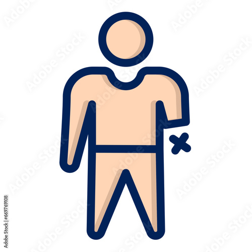 hand amputation