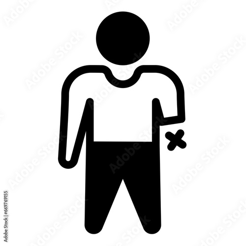 hand amputation