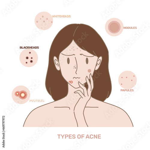 Woman with types of acne on face. Girl touching face by hand.  Hand drawn flat cartoon character vector illustration.