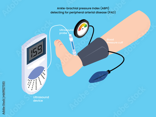 Peripheral artery disease ankle brachial index ABI test isometric 3d vector concept for illustration, banner, website, landing page, flyer, etc.