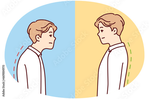 Comparison of man with good and bad back posture. Male suffer from scolisosis from sedentary work. Vector illustration.