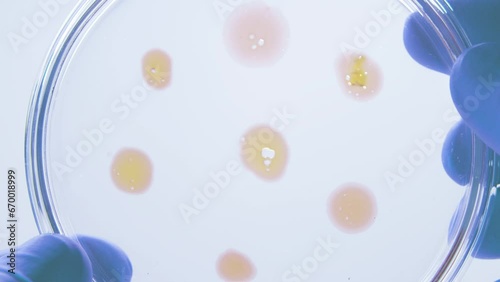 Discover the captivating growth of bacteria and microbial cultures flourishing on a petri dish. Dive into the world of Candida auris, a remarkable biomarker, and explore the realm of bio-reagents. photo