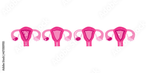 Menstrual cycle stages infographic illustration. Female uterus, woman. Vector illustration in flat style.