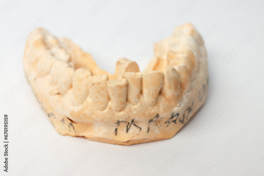 Close up of An impression or plaster mold of a man’s lower teeth