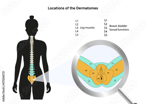 Location of the dermatomes female and male with spinal cord photo