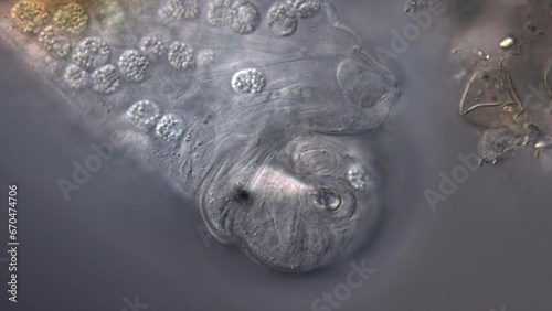 Tardigrade Head looking straight at camera magnified 1000x photo