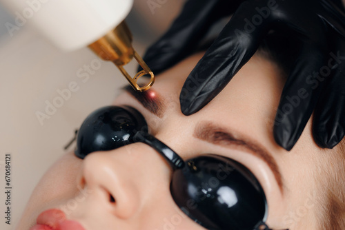 Laser removal of tattoo permanent makeup eyebrow of young woman in salon photo