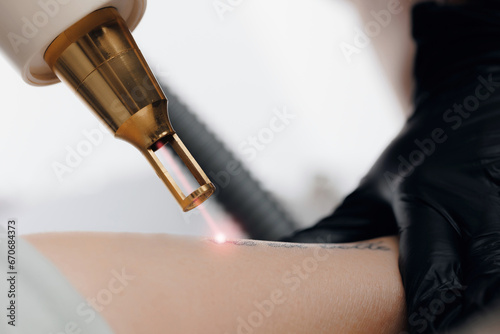 Closeup laser tattoo removal from woman hand in salon photo