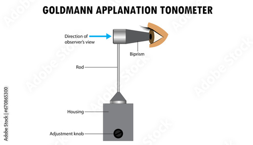 Goldeman Applanation Tonometer diagram, Instrument