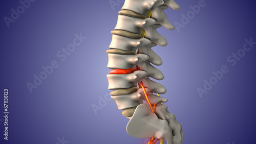 Sciatic nerve pain due to herniated disc 